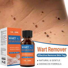 Sauvasine Wart Remover - 10ml